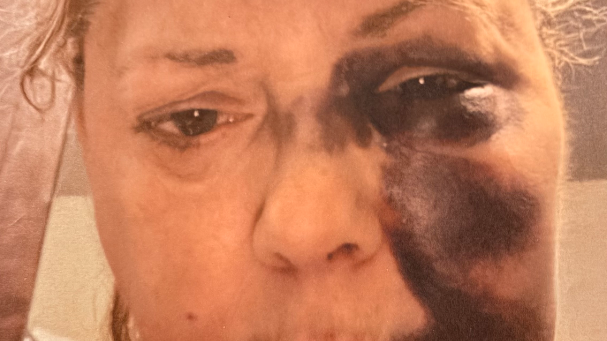 Fundraiser Image