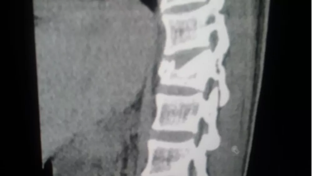 campaign image