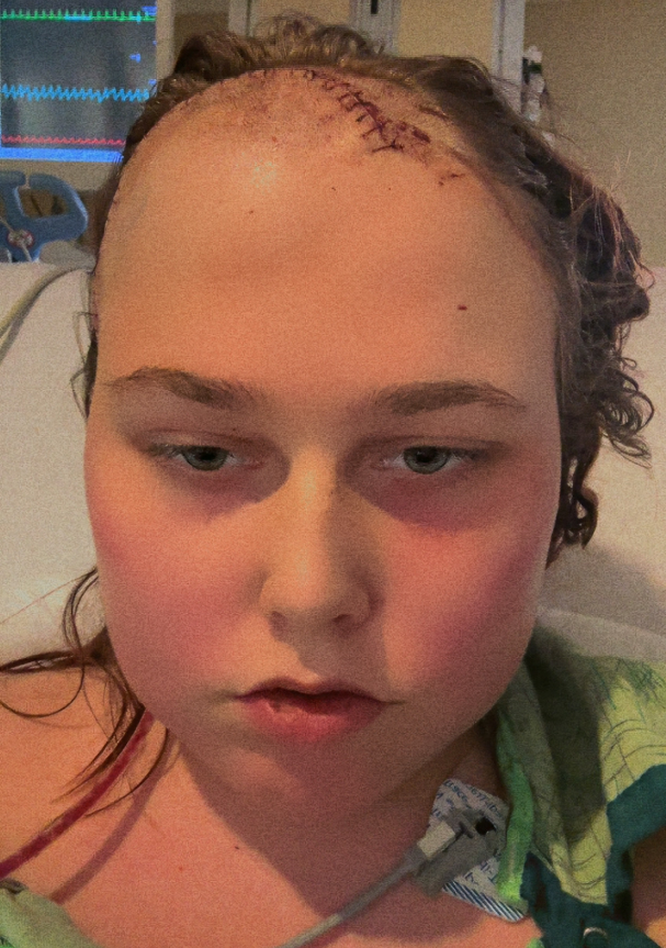 Fundraiser Image