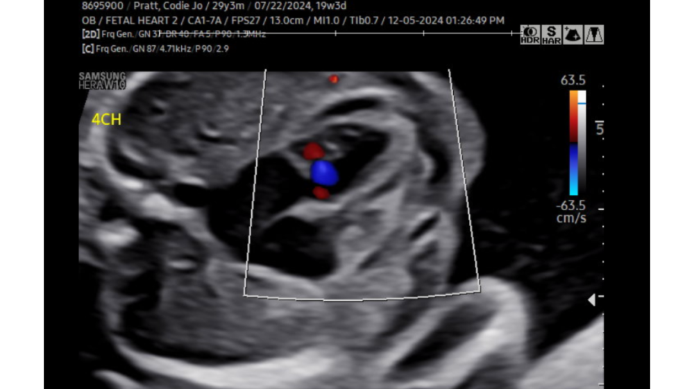 Campaign Image