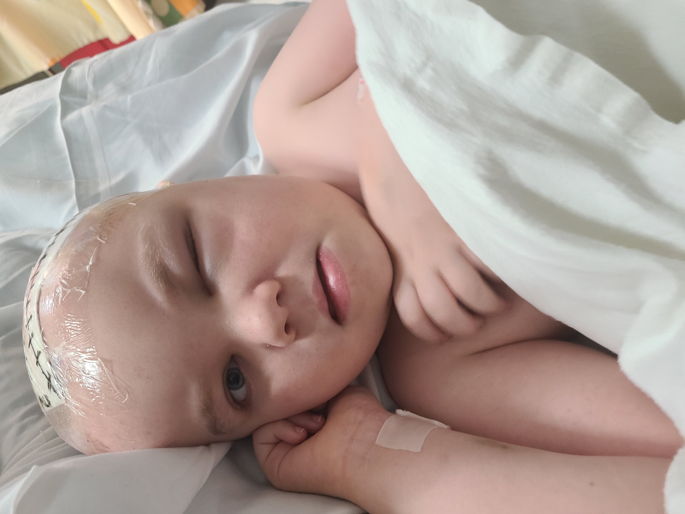 Update Out of the ICU Image