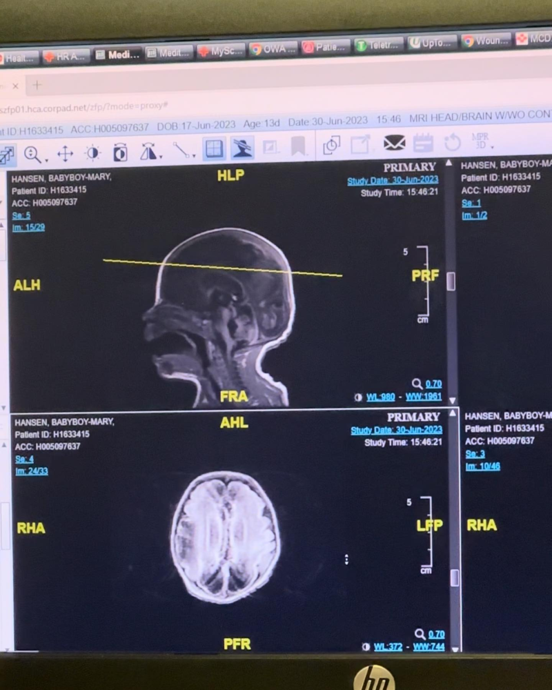 Update Update from Mary (Facebook "The Mighty Mary & Her Journey to Remission!) - July 2nd, 2023 Image