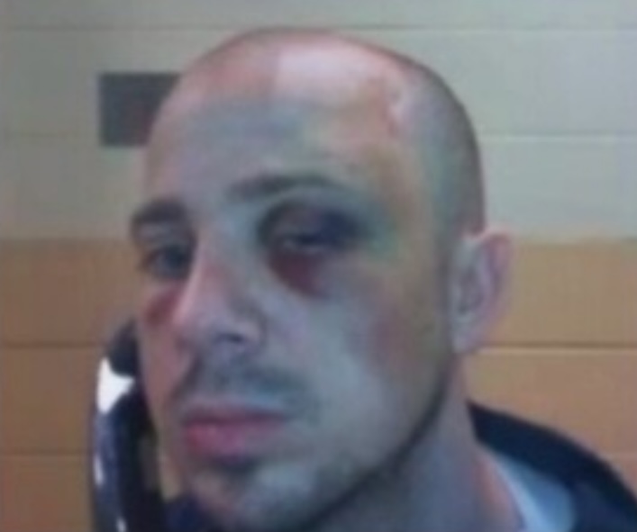 Update Update #1DC Correctional Officers Brutally Beat Jan. 6 US Capitol Protester, Zip-Tie His Hands, Fracture His Skull, Blind Him in One Eye Image