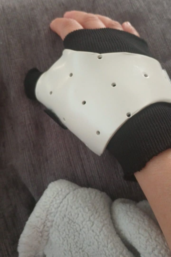 Update Renee's Post-Op Update Image