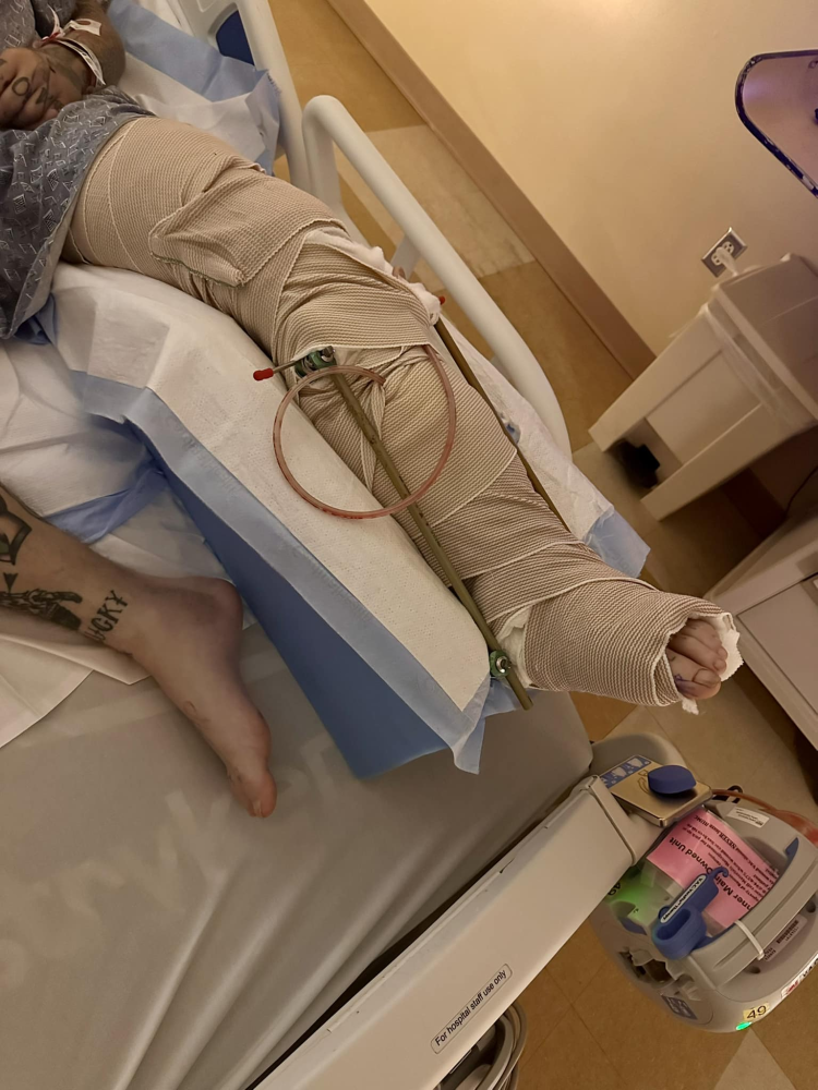 Update Update #2 Image