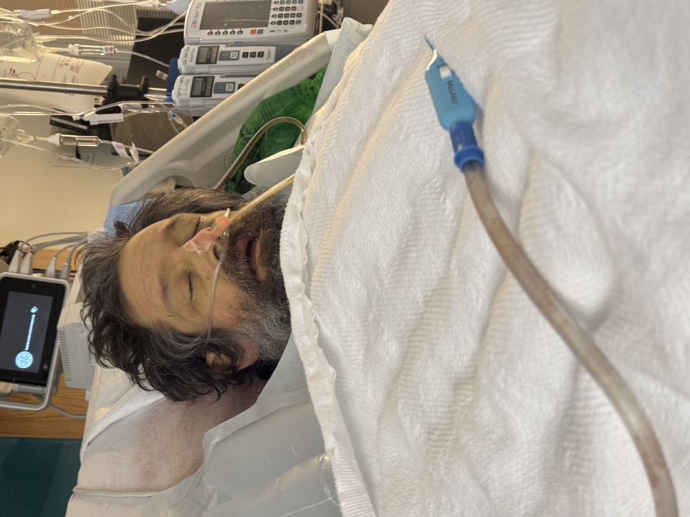 Update 36 hours post liver transplant Image
