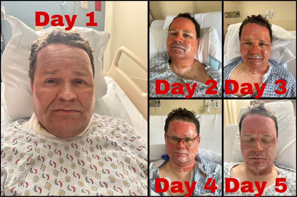 Update Sunday Update on Rob Image