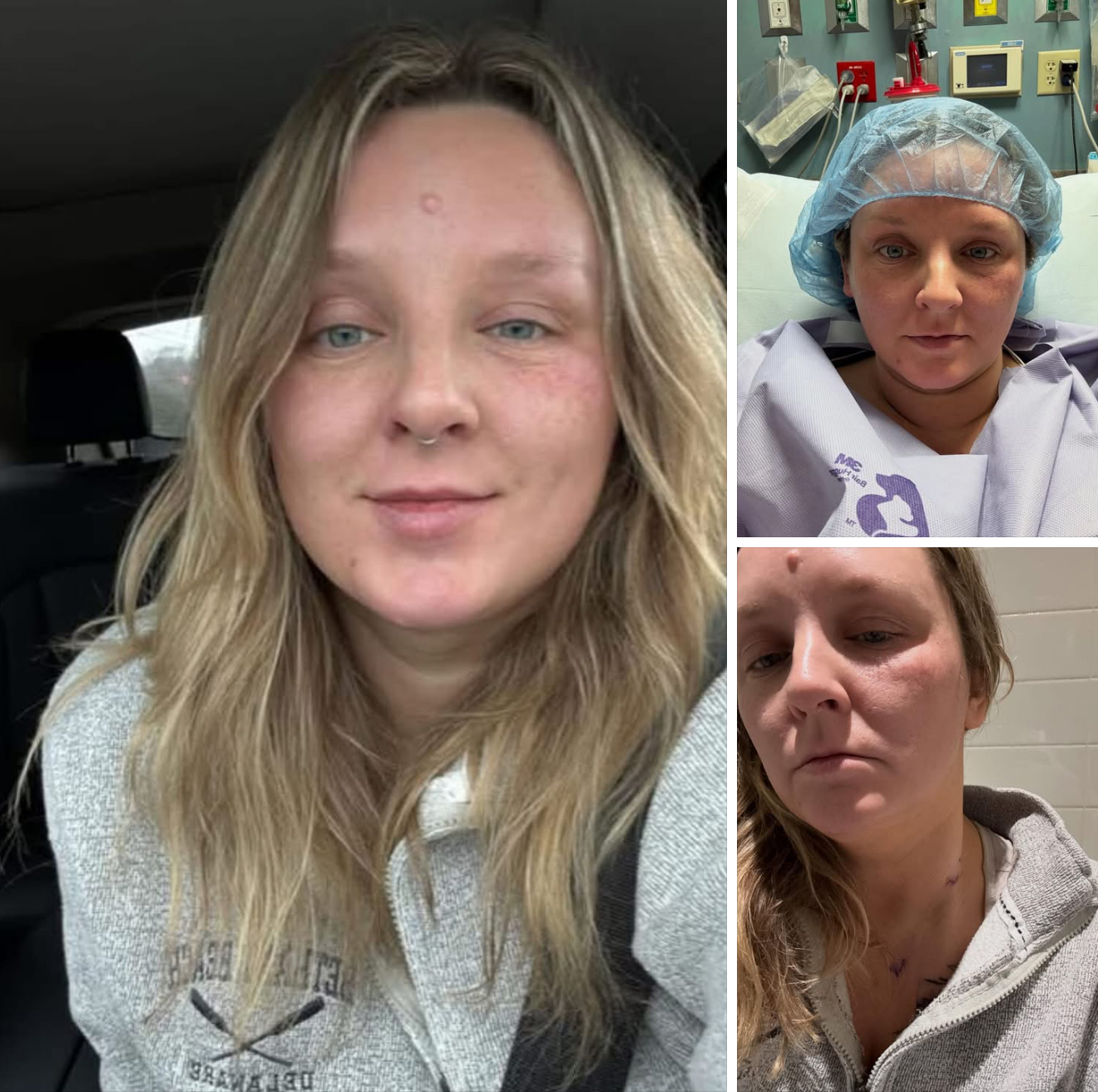 Update Update #3 - Mediport is in and treatment begins Image