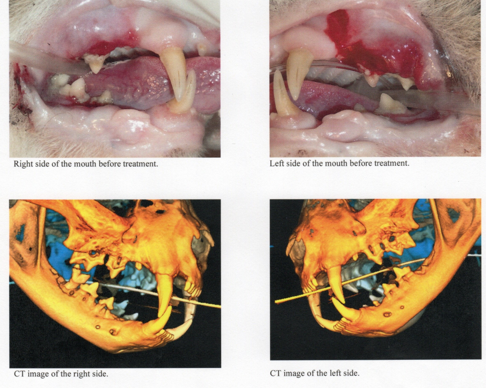 Update Update #6 - The Count's Teeth in Pictures - WARNING: Graphic!!! Image