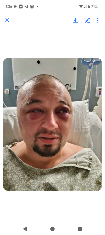 Update Update #2 Image