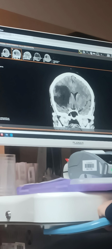 Update Update #3 Image