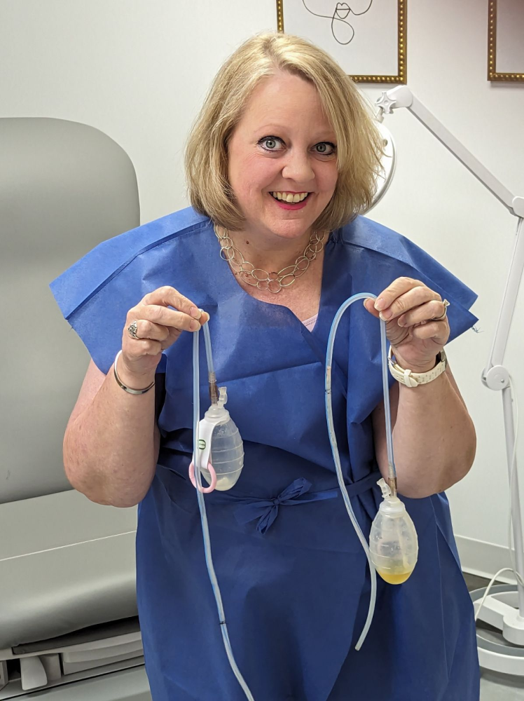 Update Update #21 - No more drains!  Next step, port and chemo. Image