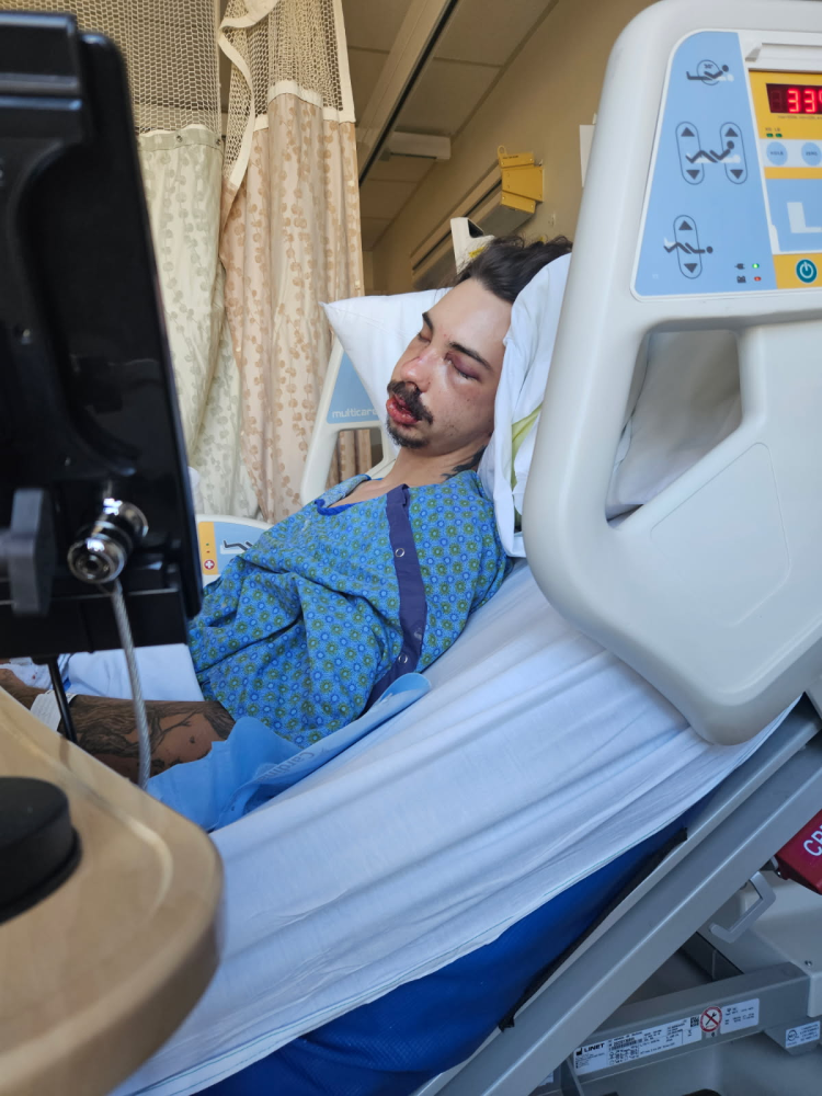 Update Update #3 - Post Reconstructive Surgery Image
